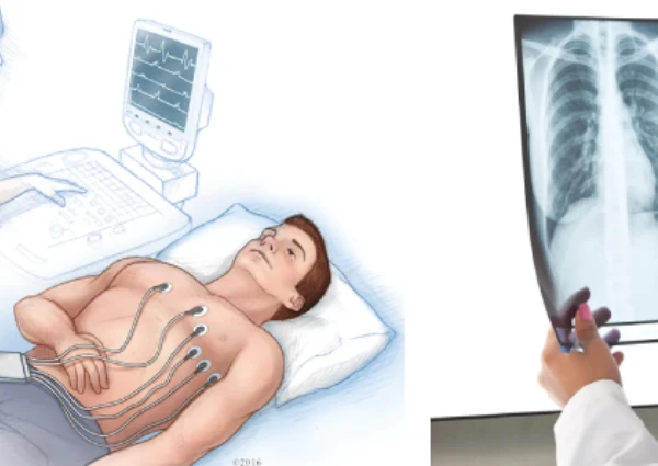 Emergency Medical Services at Home